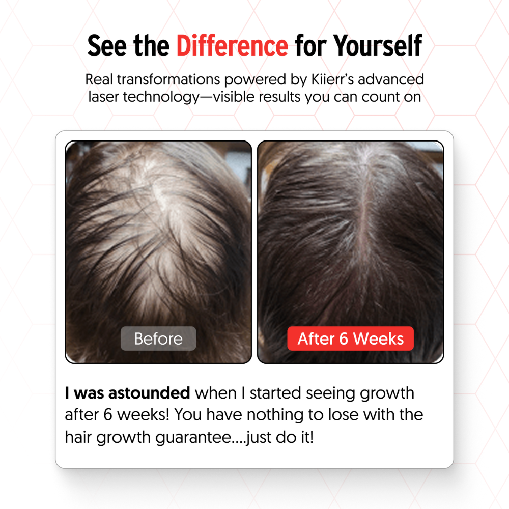 Lehora Laser Cap Hair Growth System